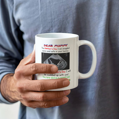 Dear Mummy - Love, Kisses and Kicks From Baby Bump - With ultrasound Image